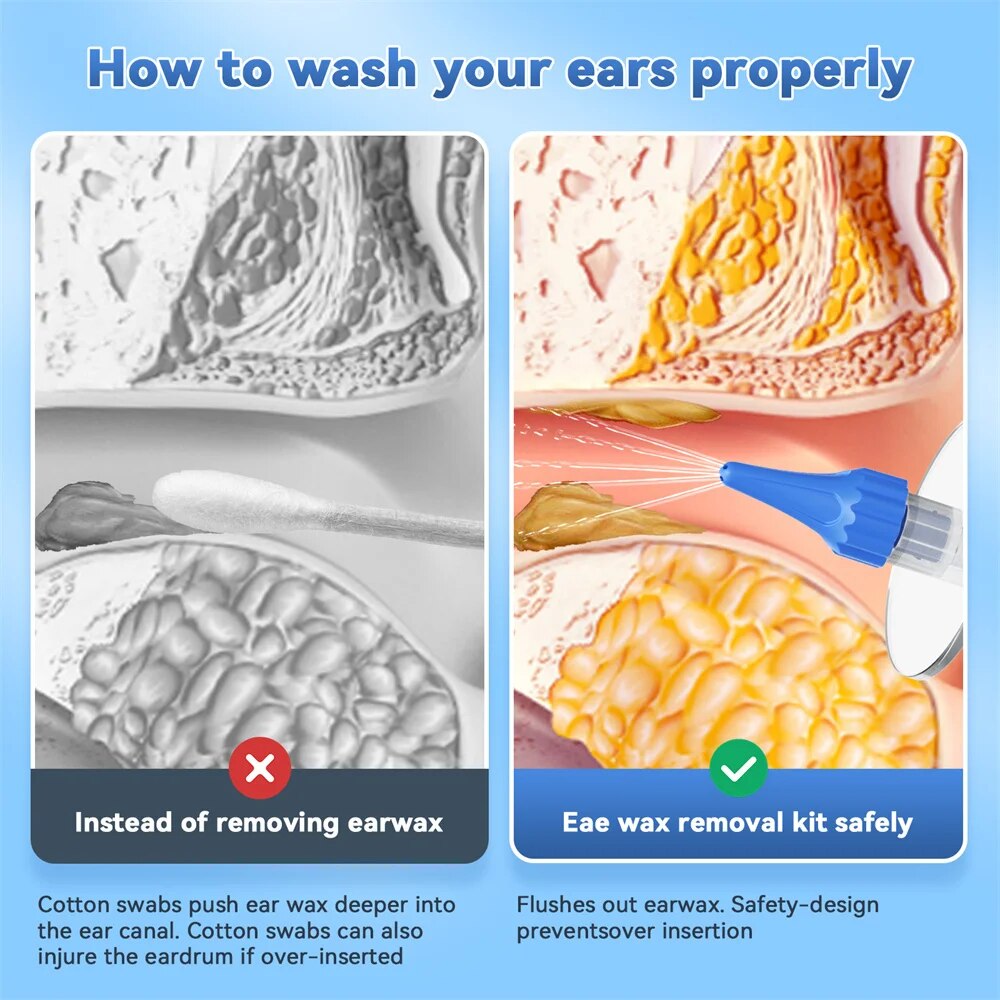 Ear Wax Removal Manual Ear Cle - Smart Garden Watering System avaliação e preço