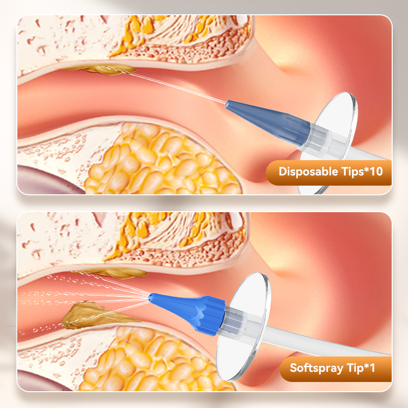 Ear Wax Removal Manual Ear Irr - Smart Garden Watering System avaliação e preço